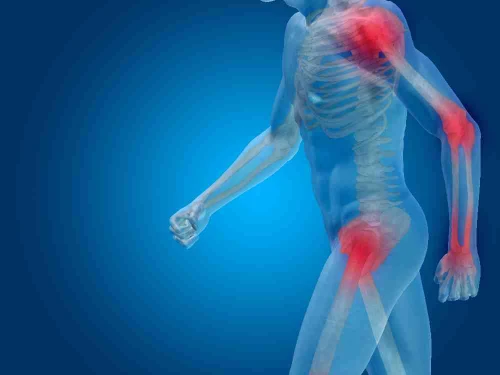 Cómo cuidar tus articulaciones a largo plazo