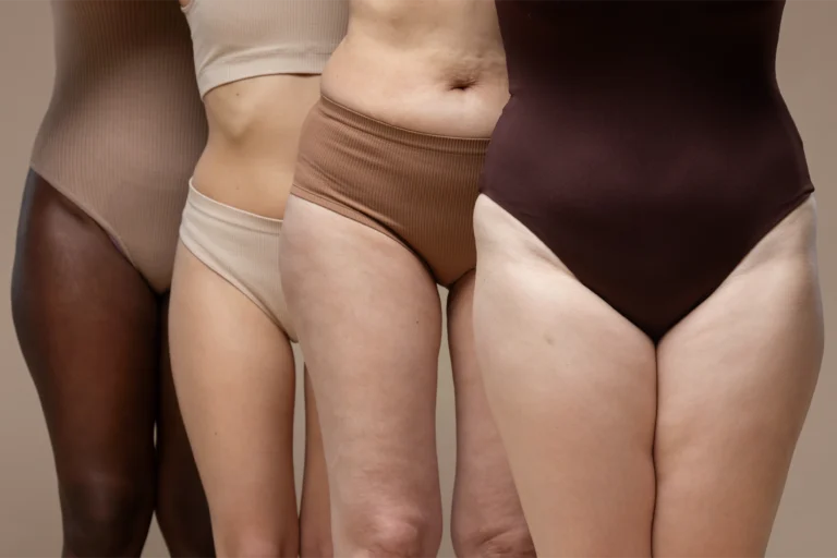 celulitis
